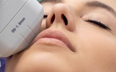HIFU Skin Tightening in Palma: The Non-Surgical Facelift That Actually Works