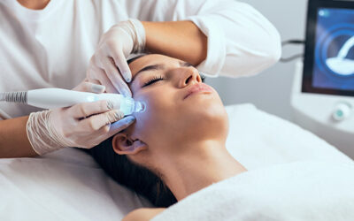 Radiofrequency Microneedling in Palma de Mallorca